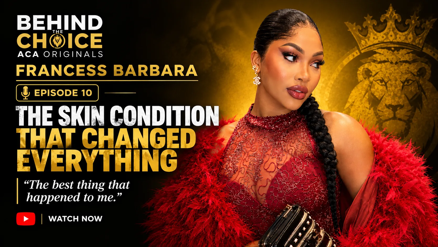 Francess Barbara in a burgundy beaded gown and red feather wrap holding a star-studded clutch, beside the Behind The Choice Episode 10 title The Skin Condition That Changed Everything